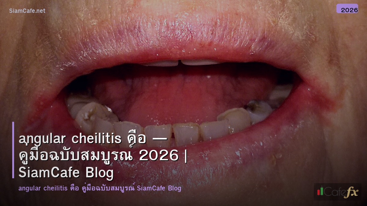angular cheilitis คอ