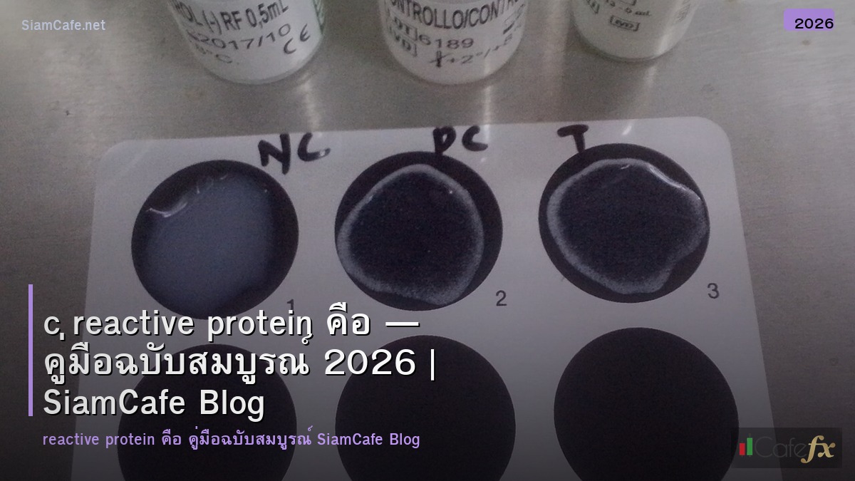 c reactive protein คอ