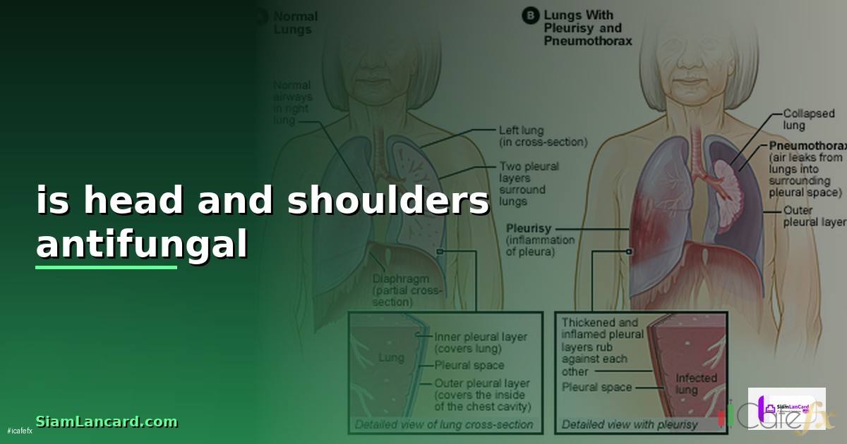 is head and shoulders antifungal —