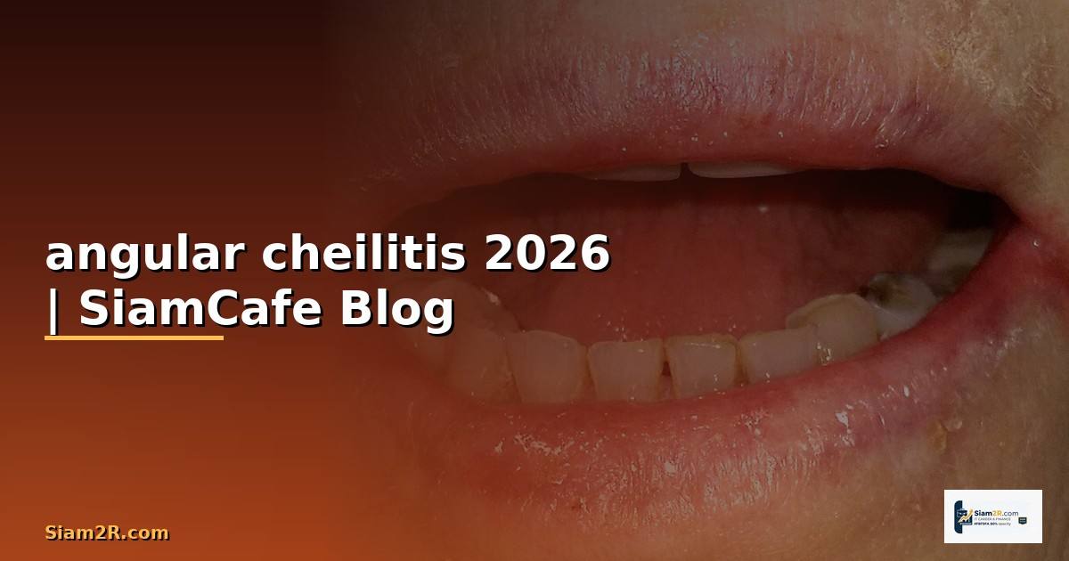 angular cheilitis คือ