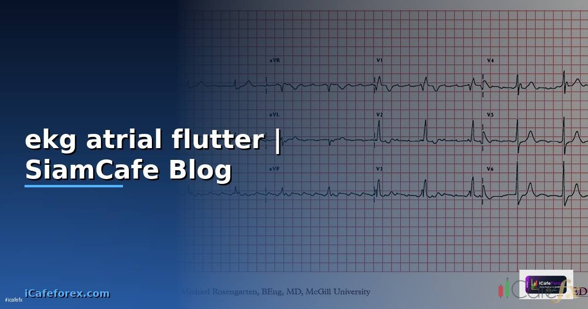 ekg atrial flutter คือ