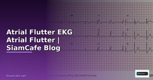 Atrial Flutter EKG คือ — อ่านคลื่นไฟฟ้าหัวใจ
