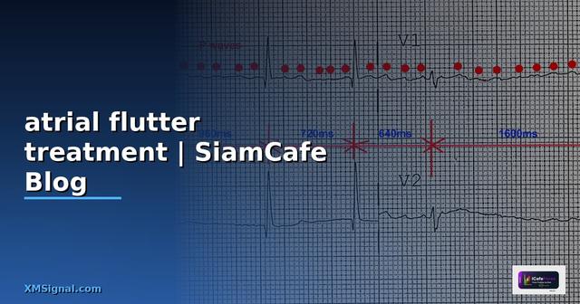 atrial flutter treatment คือ