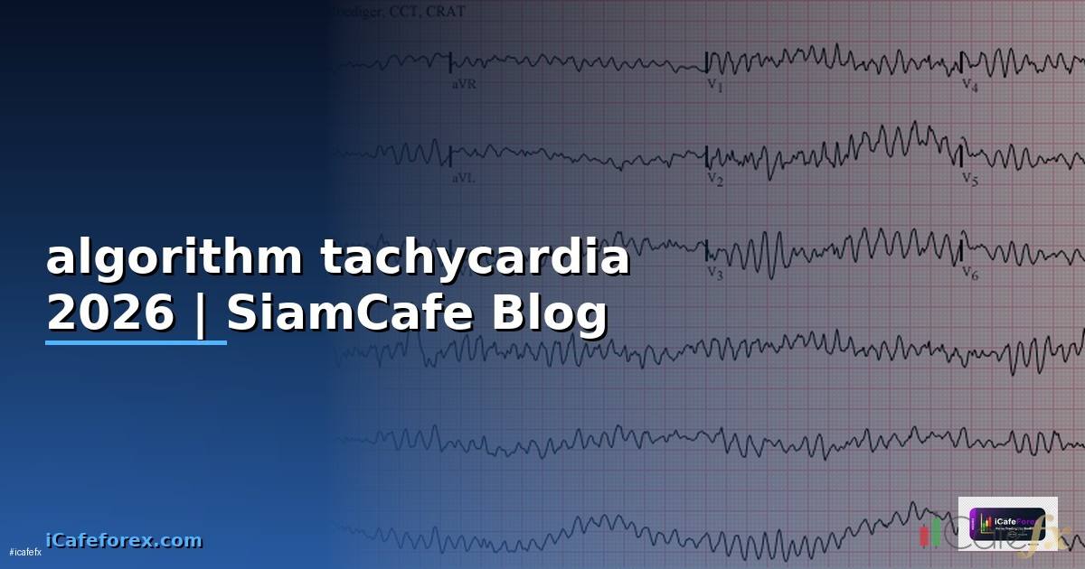 algorithm tachycardia คือ