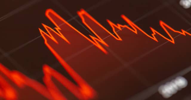 หาหุ้น day trade — ข้อมูลครบถ้วน 2026